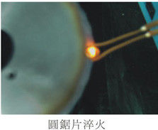 Ultrahochfrequenz-Induktionsschmelzanlage 1-2 MHz